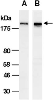 SMARCA2 (vPairTM) Antibodies