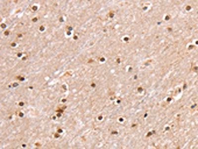 SMARCB1 Antibody