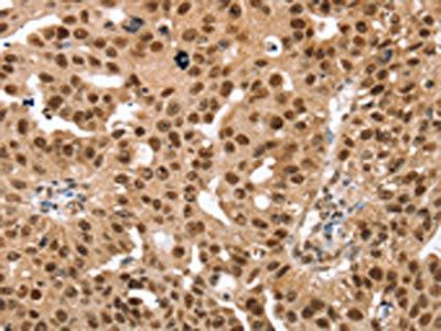 SMARCB1 Antibody