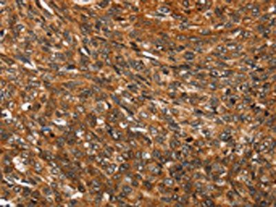 SMARCB1 Antibody
