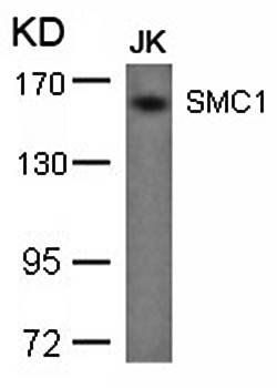 SMC1 (Ab-957) Antibody