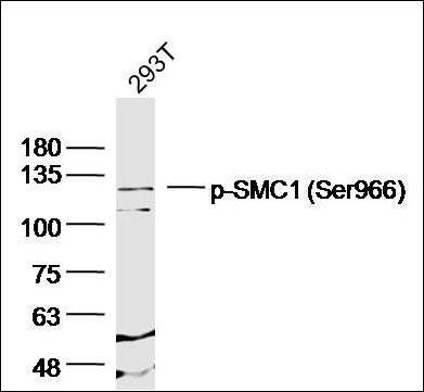 Phospho-SMC1 (Ser966) Rabbit Polyclonal Antibody
