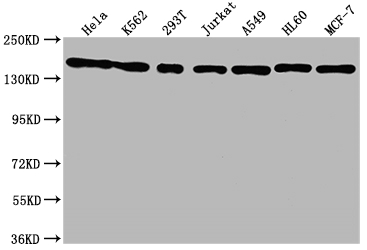 SMC1A Recombinant Monoclonal Antibody