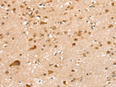 SMC6 Antibody