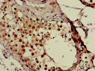 SMN1 Antibody