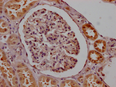 SMN1 Recombinant Monoclonal Antibody