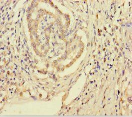 SMPD3 Antibody