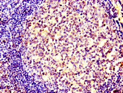SMURF2 Antibody