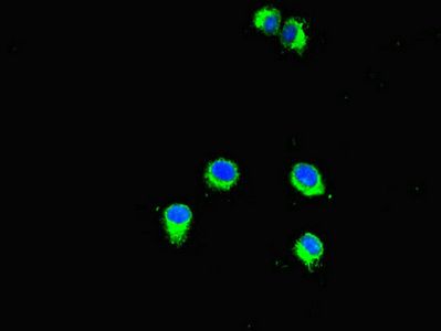 SMYD2 Antibody