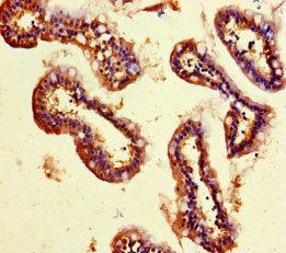 SMYD2 Antibody