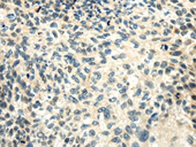 SMYD2 Antibody