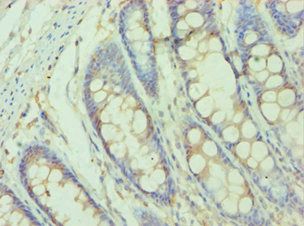 SMYD3 Antibody