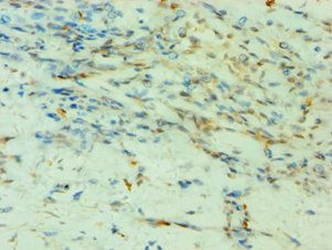 SMYD3 Antibody