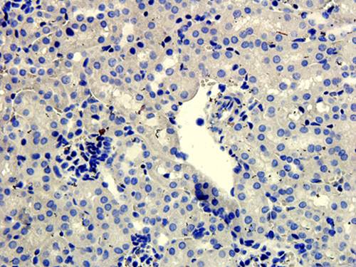 SNAIL antibody