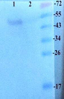 SNAIL antibody