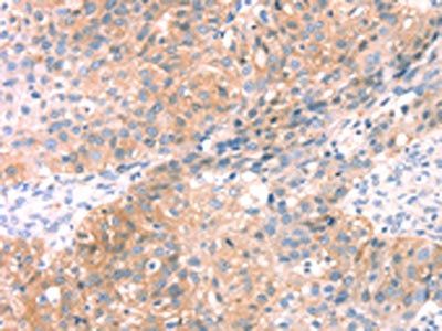 SNAP23 Antibody