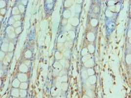 SNAP25 Antibody