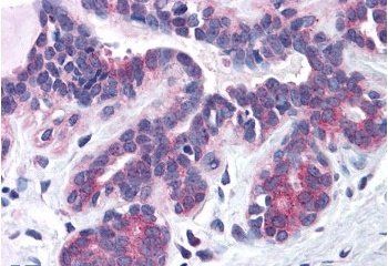 SNX16 Antibody