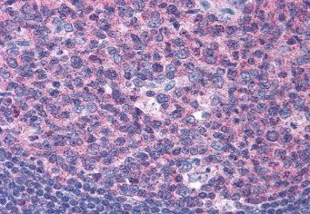SNX16 Antibody