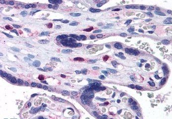SNX16 Antibody