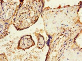 SOCS6 Antibody