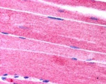 SORBS1/Ponsin (C Terminus) Antibody
