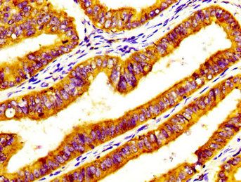 SORT1 Antibody