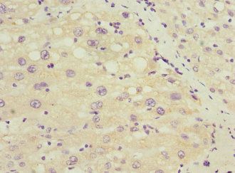 SOX5 Antibody