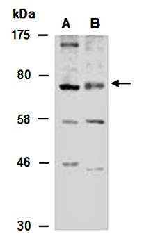 SOX5 (N) Antibody, Rabbit Polyclonal