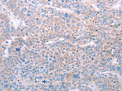 SPATA6 Antibody