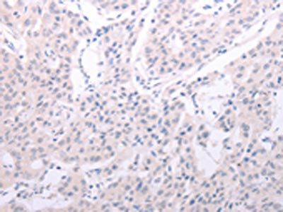 SPATA6 Antibody
