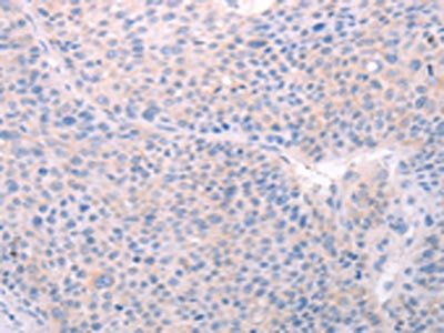 SPATA6 Antibody