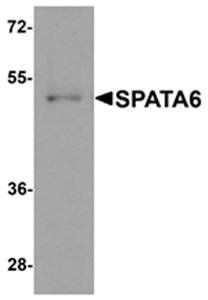 SPATA6 Antibody