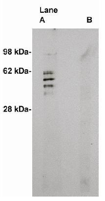 Rabbit anti Human Sphingomyelin Synthase 2 (Peptide as antigen)