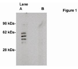 Rabbit anti Human Sphingomyelin Synthase 2