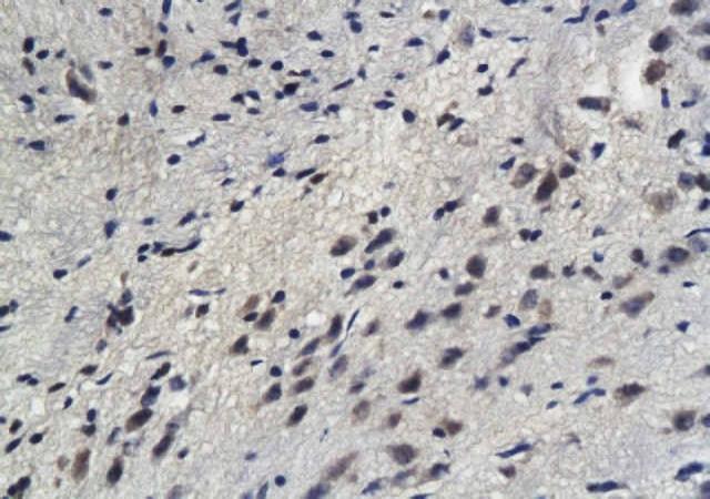 Sphingomyelin Synthase 1 Rabbit Polyclonal Antibody