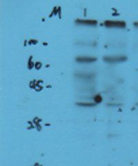 Sphingomyelin Synthase 1 Rabbit Polyclonal Antibody