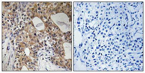 SPHK2 (Phospho-Thr614) Antibody