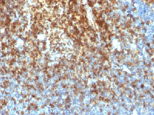 Recombinant CD43 (T-Cell Marker) Antibody