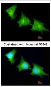 SPR antibody [N2C3]