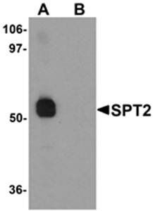 SPT2 Antibody
