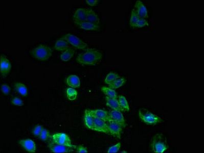 SPTLC2 Antibody
