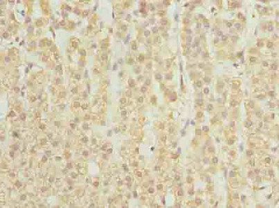 SPTLC2 Antibody