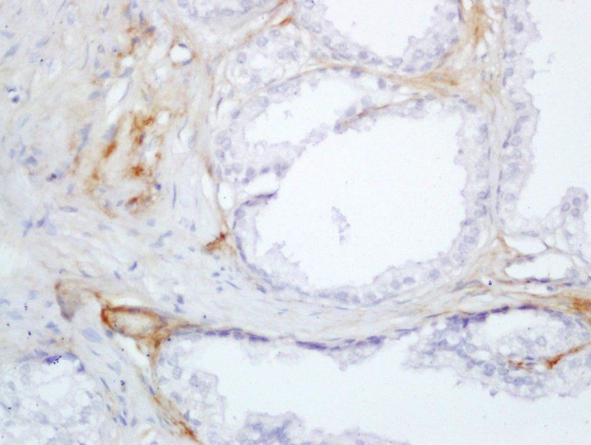 SRD5A2 Rabbit Polyclonal Antibody