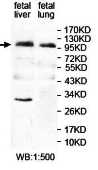 ANKRD44 Rabbit Polyclonal Antibody