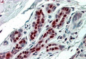 SSP29/ANP32B Antibody
