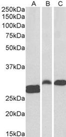SSP29/ANP32B Antibody
