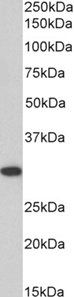 SSP29/ANP32B Antibody
