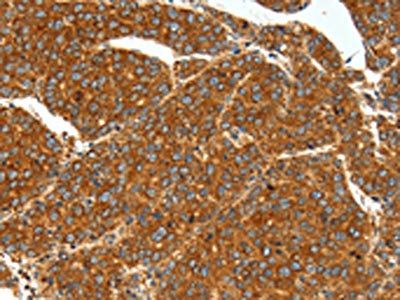 SSTR1 Antibody