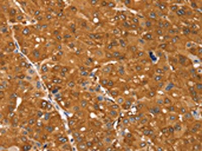 SSTR3 Antibody